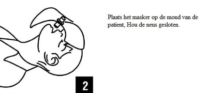 Kiss of Life Beademingsdoekje voor Hygiënisch Reanimeren Veilig Beademen met Eenrichtingsventiel - VCTparts.nl